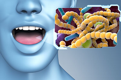 The image shows a 3D rendering of a human mouth with the tongue sticking out, and to the right is a graphic representation of bacteria or microorganisms. There s a label that reads  Bacteria  in a speech bubble emanating from the mouth.