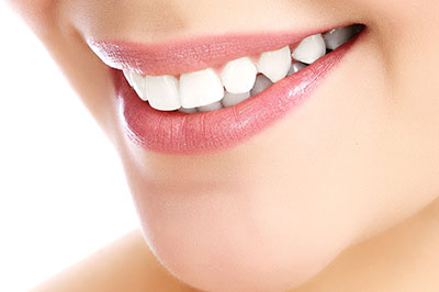 The image shows a close-up of a person s face with a focus on their teeth, which are being enhanced by a cosmetic dental treatment.