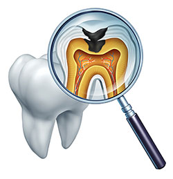 An illustration of a dental model with an open mouth, showcasing the teeth and gums, accompanied by a magnifying glass that reveals detailed internal structures, emphasizing the tooth s root canal and the surrounding tissues.