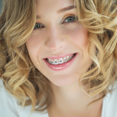 The image is a close-up portrait of a person with straight, white teeth and braces, smiling at the camera. They have short wavy hair, fair skin, and are wearing a light pink lipstick.