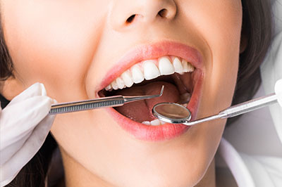 A woman undergoing dental treatment, with a dentist performing an oral examination using a mirror and a probe.